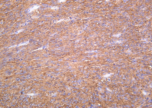 Recombinant TMEM16A Monoclonal Antibody (AGEL6330)