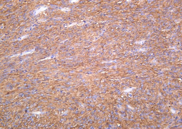 Recombinant TMEM16A Monoclonal Antibody (AGEL6330)