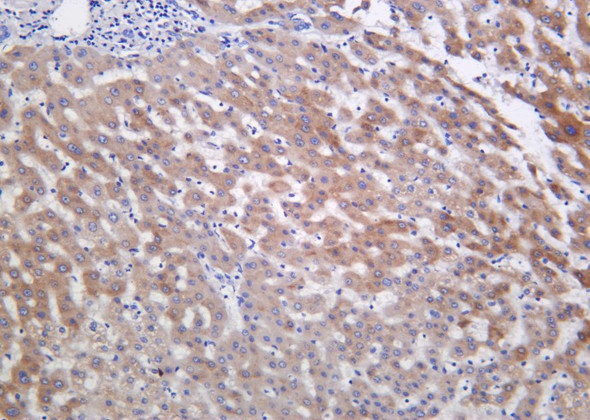 Recombinant Inhibin β-E Monoclonal Antibody (AGEL6333)
