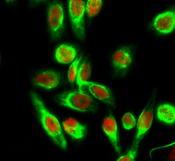 Recombinant Histone H4 (Acetyl Lys5) Monoclonal Antibody (AGEL6334)