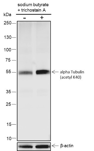 Recombinant alpha Tubulin (Acetyl K40) Monoclonal Antibody (AGEL6339)