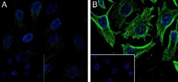 Recombinant alpha Tubulin (Acetyl K40) Monoclonal Antibody (AGEL6339)