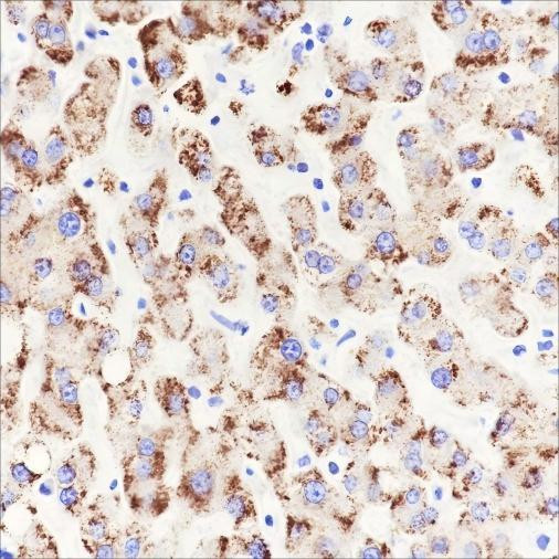 Recombinant AMACR Monoclonal Antibody (AGEL6344)