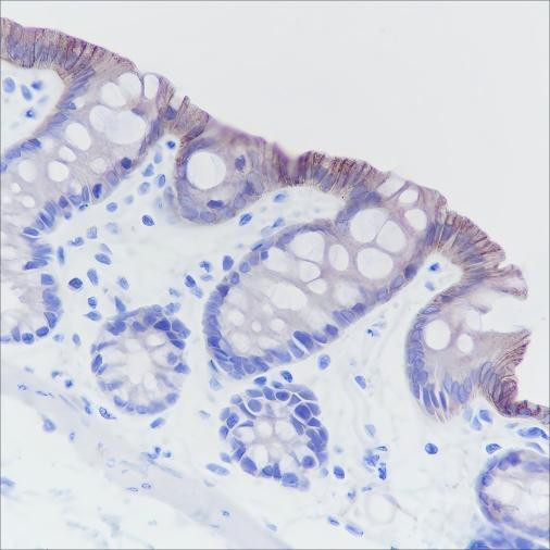 Recombinant Cadherin-17 Monoclonal Antibody (AGEL6345)