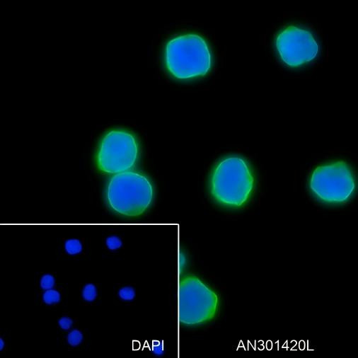 Recombinant PD1 Monoclonal Antibody (AGEL6349)