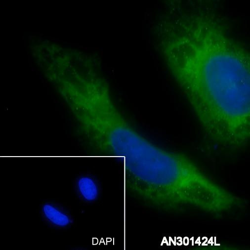 Recombinant ABCE1 Monoclonal Antibody (AGEL6353)