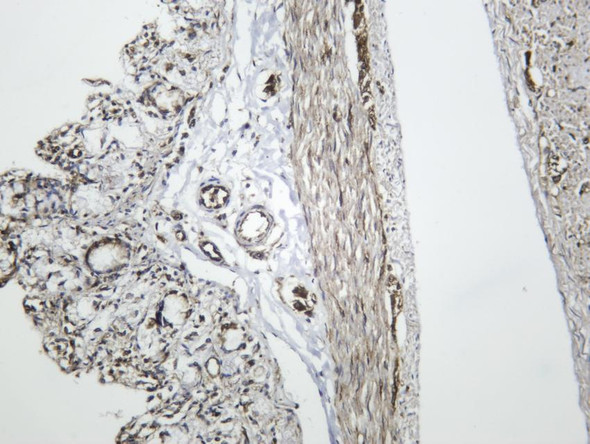Recombinant Muscarinic Acetylcholine Receptor 2/CM2 Monoclonal Antibody (AGEL6355)