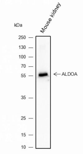 Recombinant Activin A Receptor Type IB/ALK-4 Monoclonal Antibody (AGEL6356)