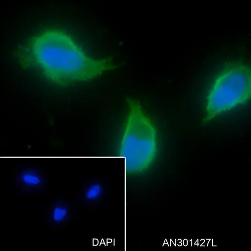 Recombinant Activin A Receptor Type IB/ALK-4 Monoclonal Antibody (AGEL6356)