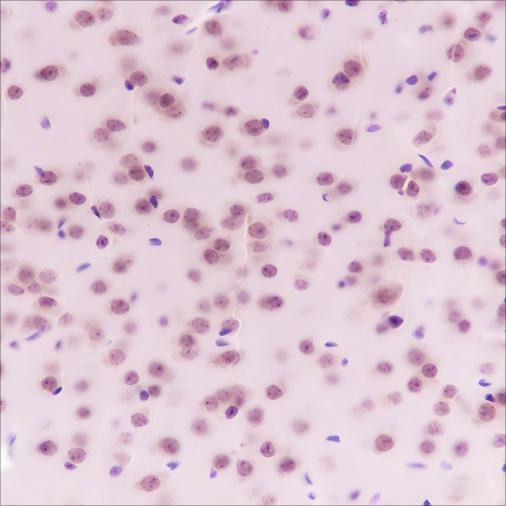 Recombinant AKT1 Monoclonal Antibody (AGEL6357)