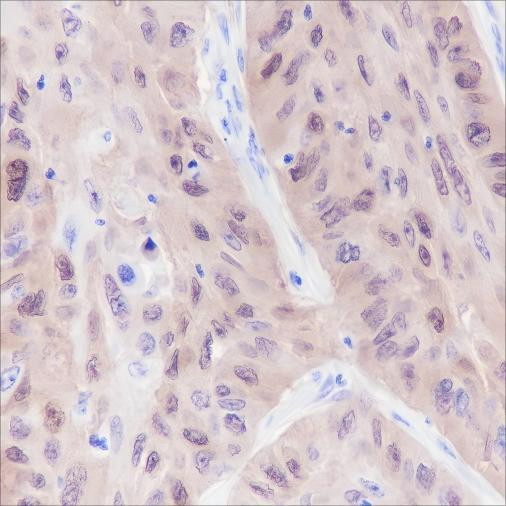 Recombinant ALDH3A1 Monoclonal Antibody (AGEL6359)
