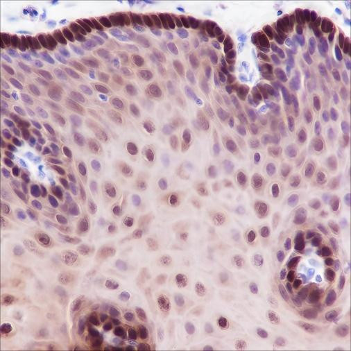 Recombinant ALDH3A1 Monoclonal Antibody (AGEL6359)