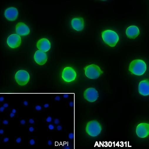 Recombinant ALDOA Monoclonal Antibody (AGEL6360)
