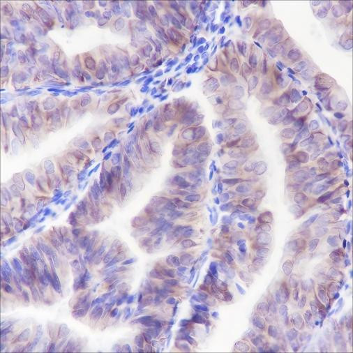 Recombinant ALOX15 Monoclonal Antibody (AGEL6361)