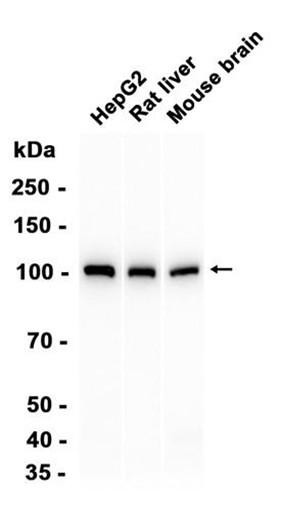 Recombinant alpha Actinin 4 Monoclonal Antibody (AGEL6362)