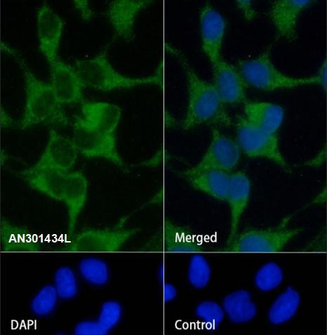 Recombinant Alpha B Crystallin Monoclonal Antibody (AGEL6363)