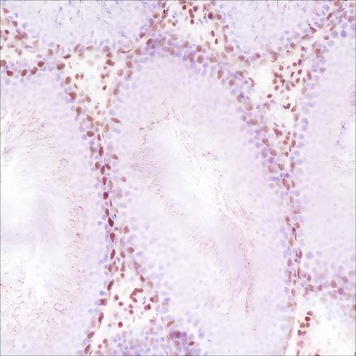 Recombinant Androgen Receptor (CT) Monoclonal Antibody (AGEL6366)