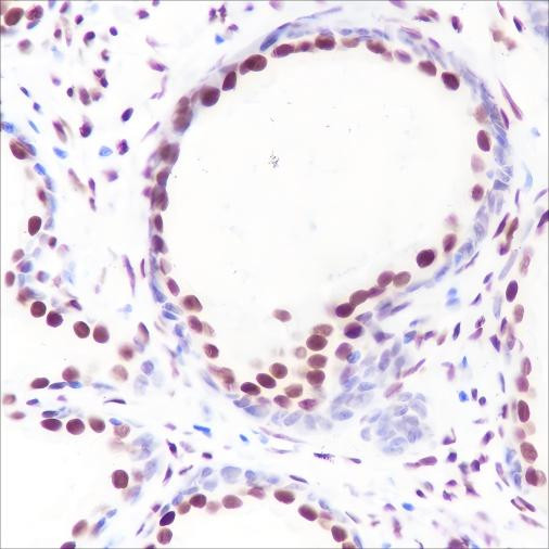 Recombinant Androgen Receptor (CT) Monoclonal Antibody (AGEL6366)
