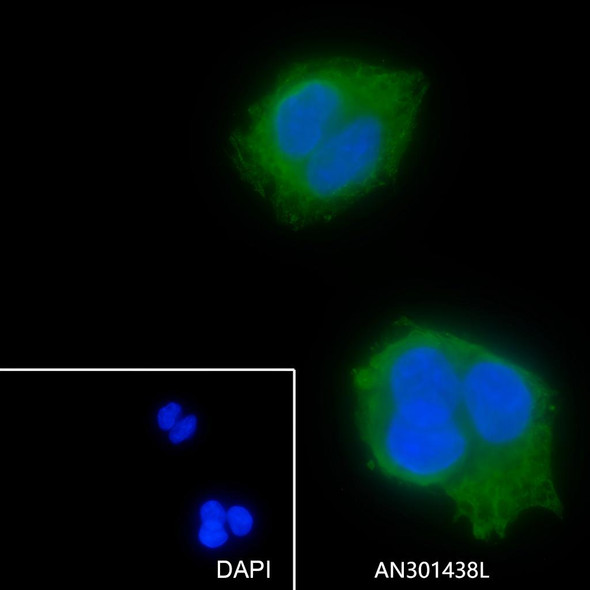 Recombinant ANGPTL3 Monoclonal Antibody (AGEL6367)