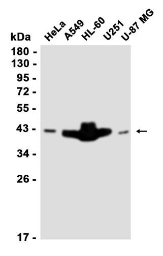 Recombinant Ataxin-3 Monoclonal Antibody (AGEL6369)