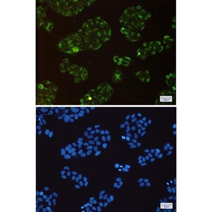 Recombinant BAP31 Monoclonal Antibody (AGEL6372)