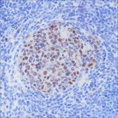 Recombinant BCL6 Monoclonal Antibody (AGEL6373)