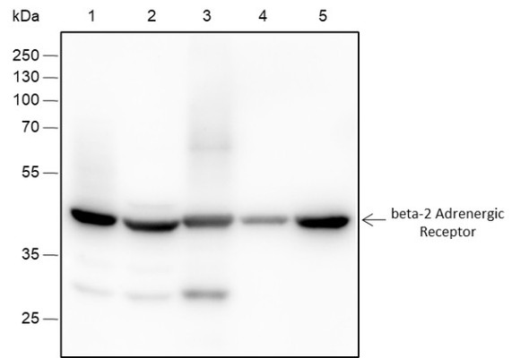 Recombinant beta-2 Adrenergic Receptor Monoclonal Antibody (AGEL6374)