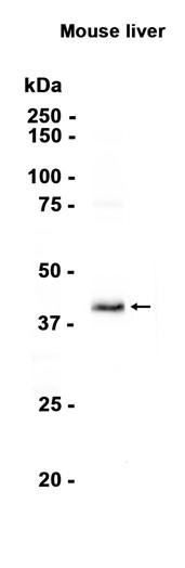 Recombinant BHMT Monoclonal Antibody (AGEL6375)
