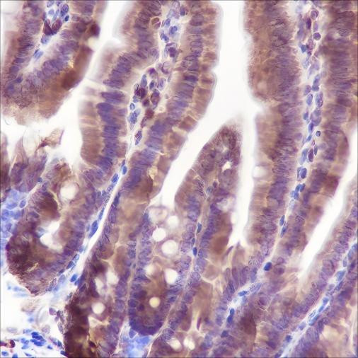 Recombinant Bid Monoclonal Antibody (AGEL6376)