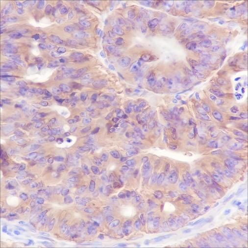 Recombinant Bid Monoclonal Antibody (AGEL6376)