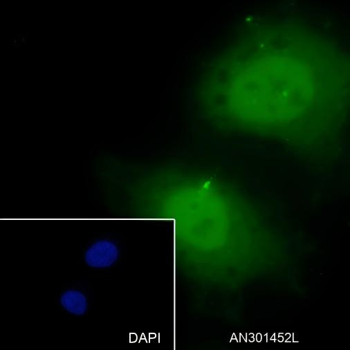 Recombinant Caldesmon/CDM Monoclonal Antibody (AGEL6381)