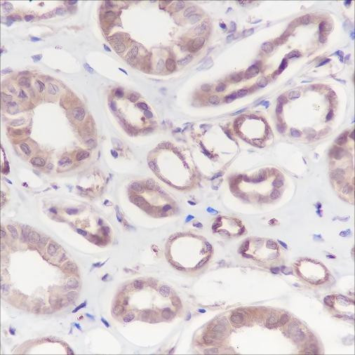 Recombinant Calpain small subunit 1 Monoclonal Antibody (AGEL6382)