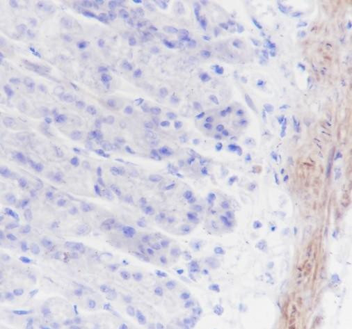 Recombinant Calponin 1 Monoclonal Antibody (AGEL6384)