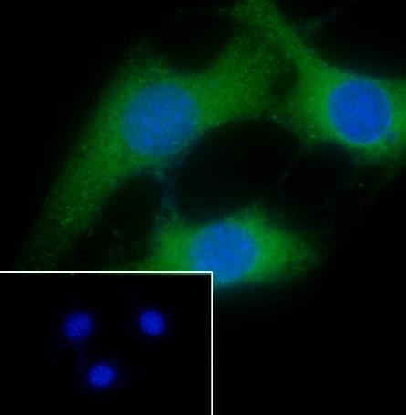Recombinant Calponin 1 Monoclonal Antibody (AGEL6384)