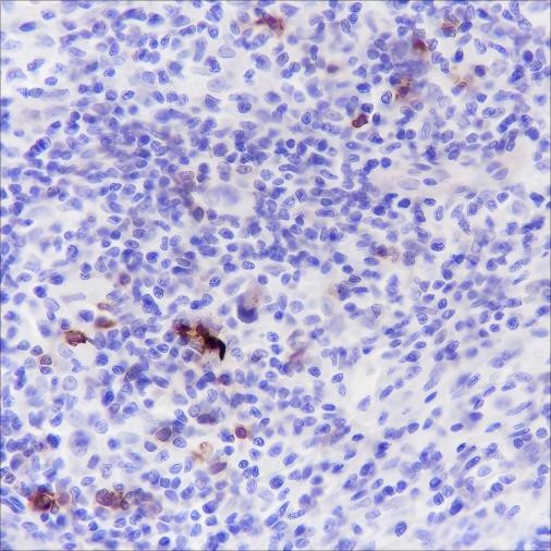 Recombinant CD134/OX40 Monoclonal Antibody (AGEL6391)