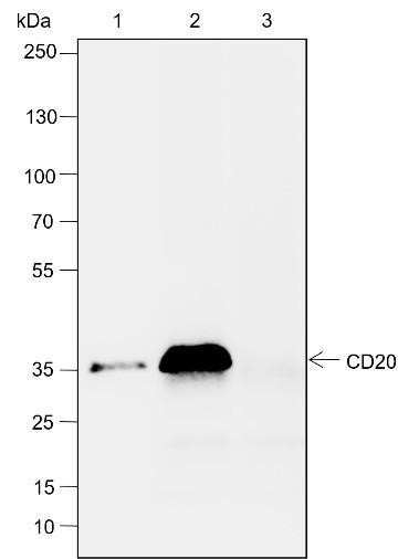 Recombinant CD20 Monoclonal Antibody (AGEL6399)