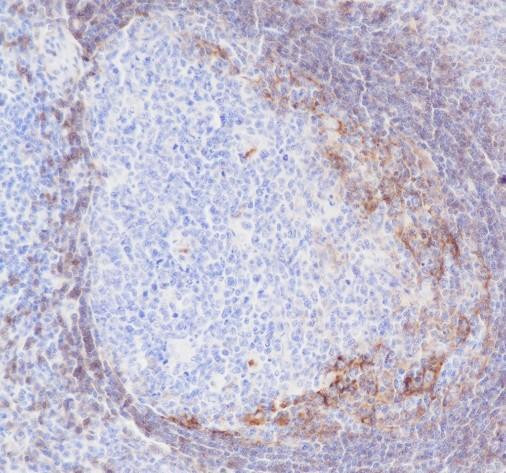 Recombinant CD23 Monoclonal Antibody (AGEL6400)