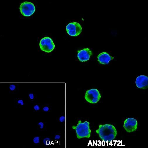 Recombinant CD25 Monoclonal Antibody (AGEL6401)