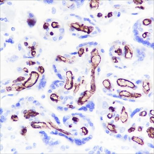 Recombinant CD32B Monoclonal Antibody (AGEL6403)