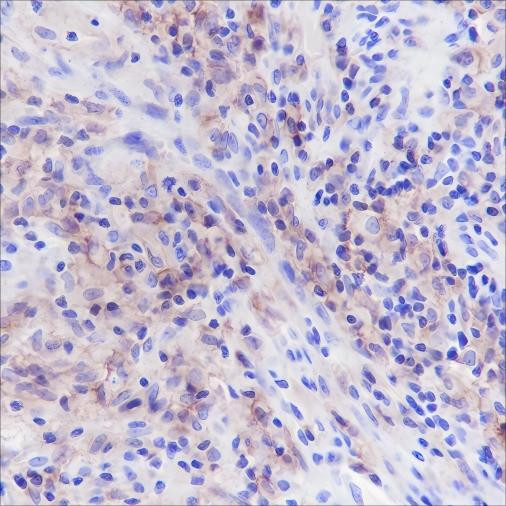 Recombinant CD33 Monoclonal Antibody (AGEL6404)