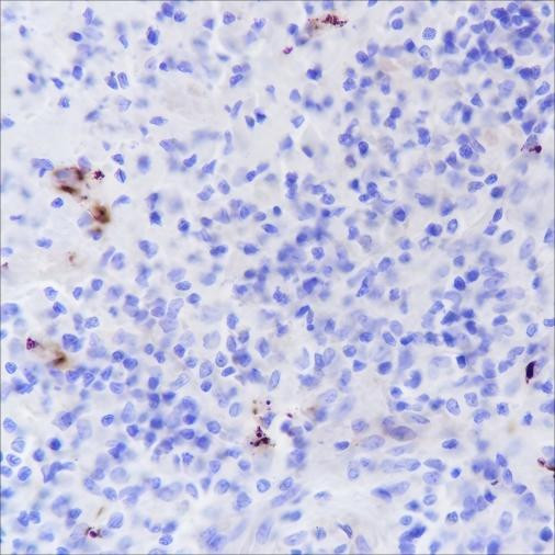 Recombinant CD42b Monoclonal Antibody (AGEL6408)