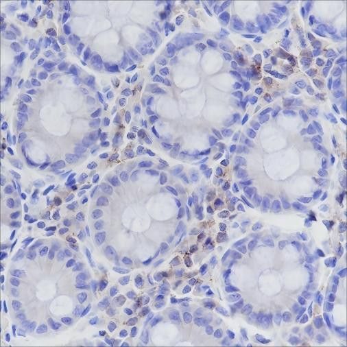 Recombinant CD50/ICAM3 Monoclonal Antibody (AGEL6410)