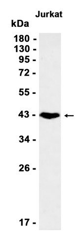 Recombinant CD79a Monoclonal Antibody (AGEL6415)