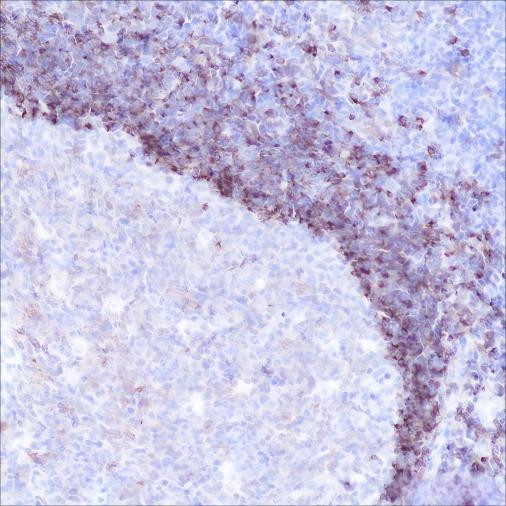 Recombinant CD79b Monoclonal Antibody (AGEL6416)