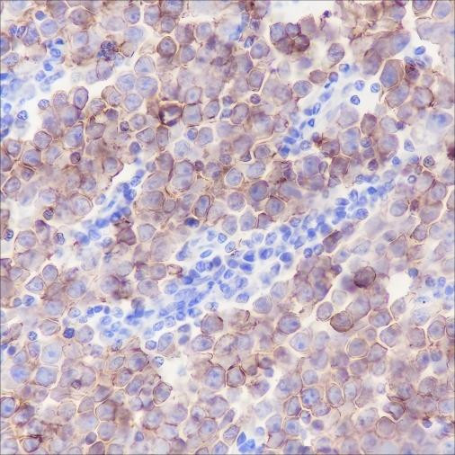 Recombinant c-Kit Monoclonal Antibody (AGEL6420)