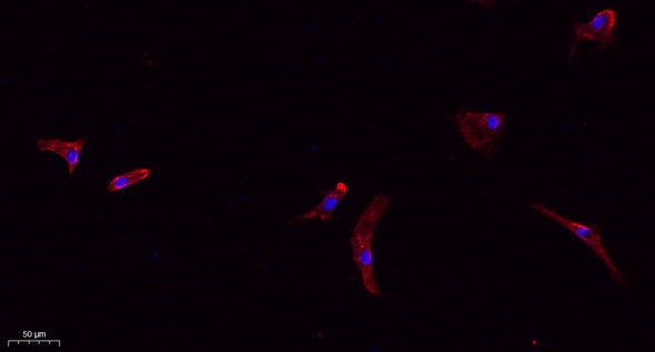 Recombinant Claudin-1 Monoclonal Antibody (AGEL6421)