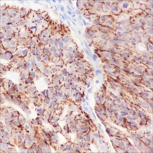 Recombinant Claudin-7 Monoclonal Antibody (AGEL6422)