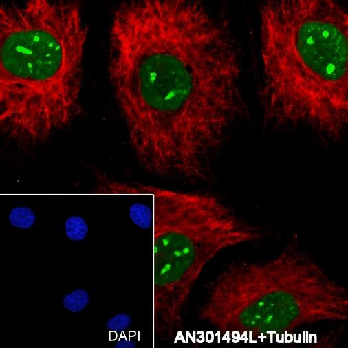 Recombinant Cleaved PARP1 p25 Monoclonal Antibody (AGEL6423)