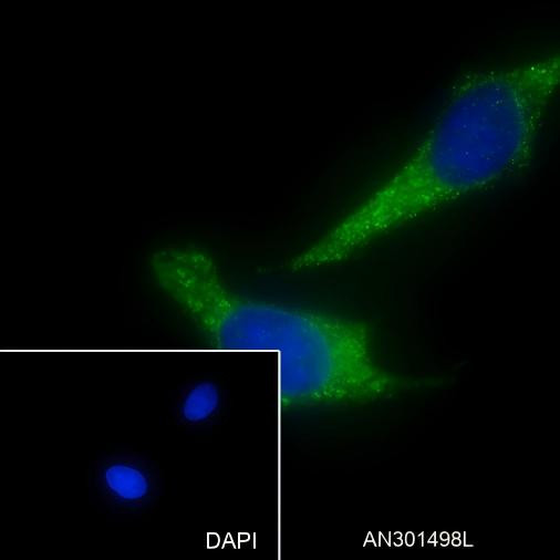 Recombinant Cpn10 Monoclonal Antibody (AGEL6427)
