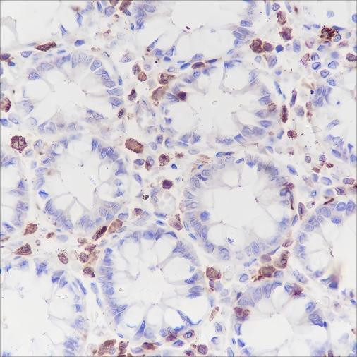 Recombinant CSF-1R Monoclonal Antibody (AGEL6429)